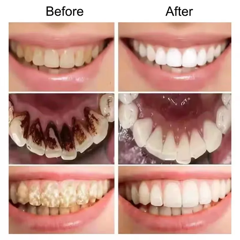 7.5% Hydroxyapatite Probiotic - Teeth Whitening That Works ulasan dan harga