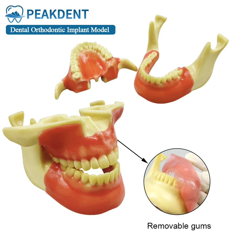 

1Pcs Dental Demonstration Orthodontic Implant Model Detachable Oral Model Dental Teeth Model Demonstration Dentistry Clinic Tool