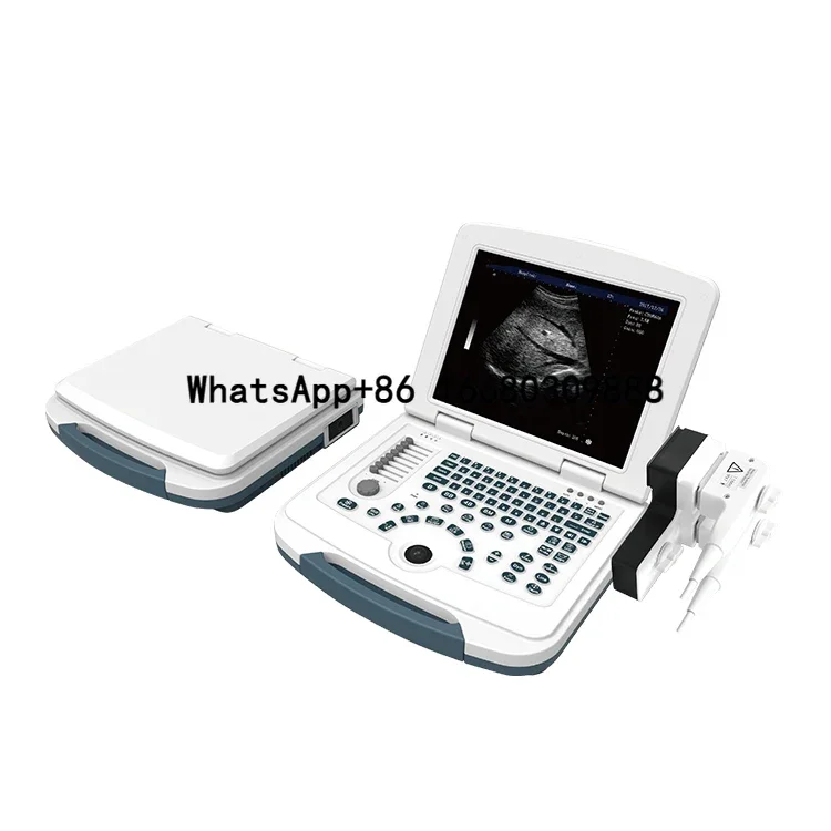 

Medical Diagnostic B&W Portable Human Cheapest Portable Ultrasound Machine with Probe