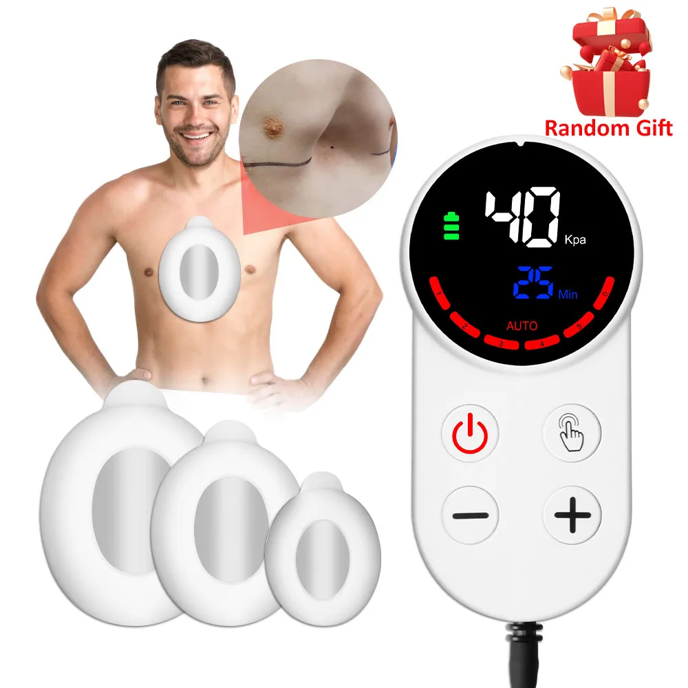 Pectus Excavatum Vacuum Bell,Pectus Excavatum Orthosis Brace,Sternal Depression Support Sunken Chest-Physical Chest Correction