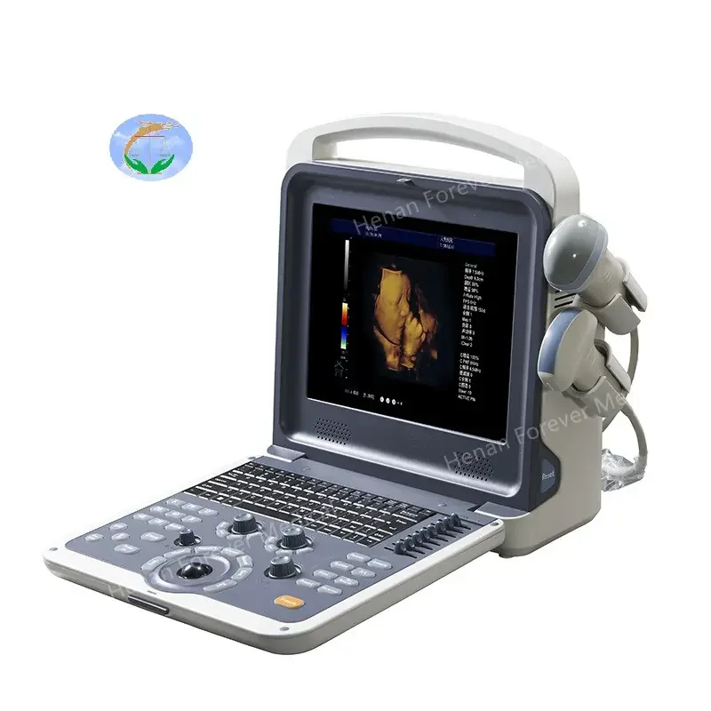 4D Full Digital Color Doppler Ultrasound Diagnostic System Competitive Price 6 Languages Portable Ultrasound