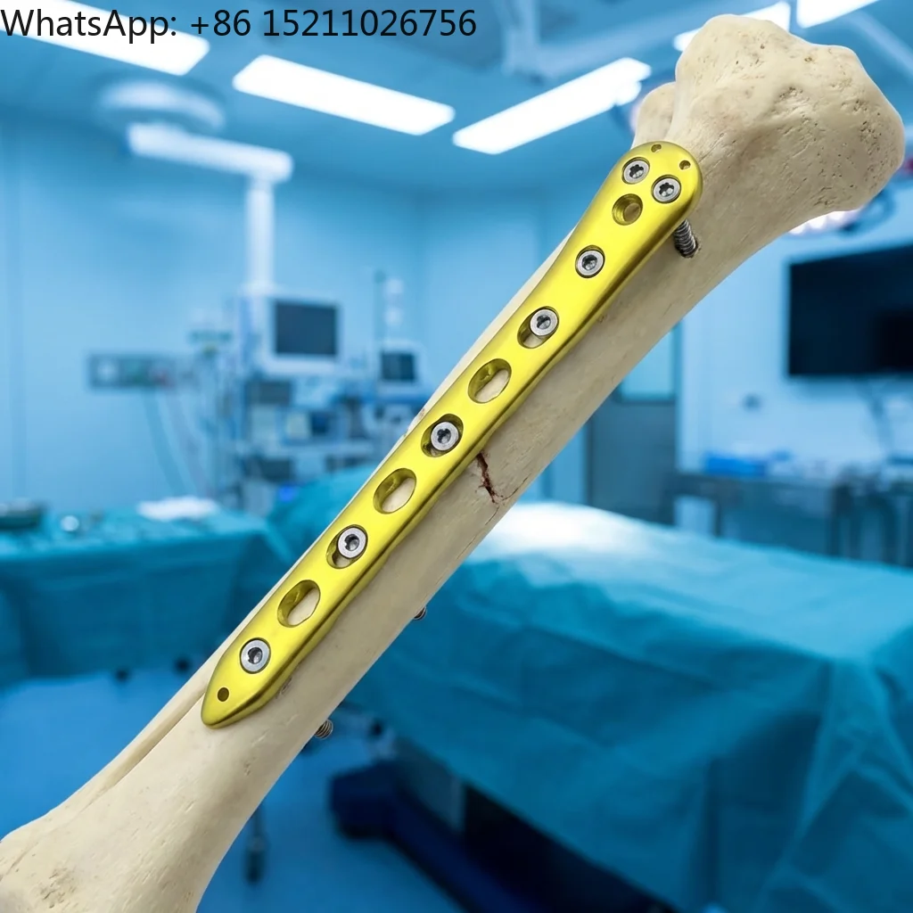 Proximal Femur Condylus Locking Plate Type III Titanium - Trauma -for Femur Fracture Fixation CE