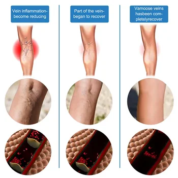 10 best sales वैरिकाज़ - №1