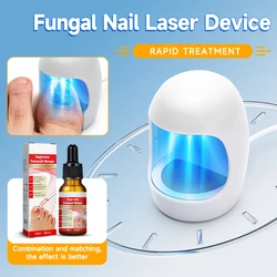 Dispositif de traitement laser pour champignon des ongles, traitement fongique, soin des pieds, essence anti-infection, paronyamieonychomycose, ongle incarné