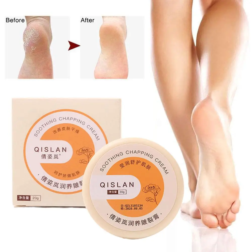 Creme anti-secagem para pés rachados, Cuidado com calcanhar rachado, Remoção de pele morta, Pés de mão, Cuidado com mãos rachadas, Foot Spa, E8I2, 20g