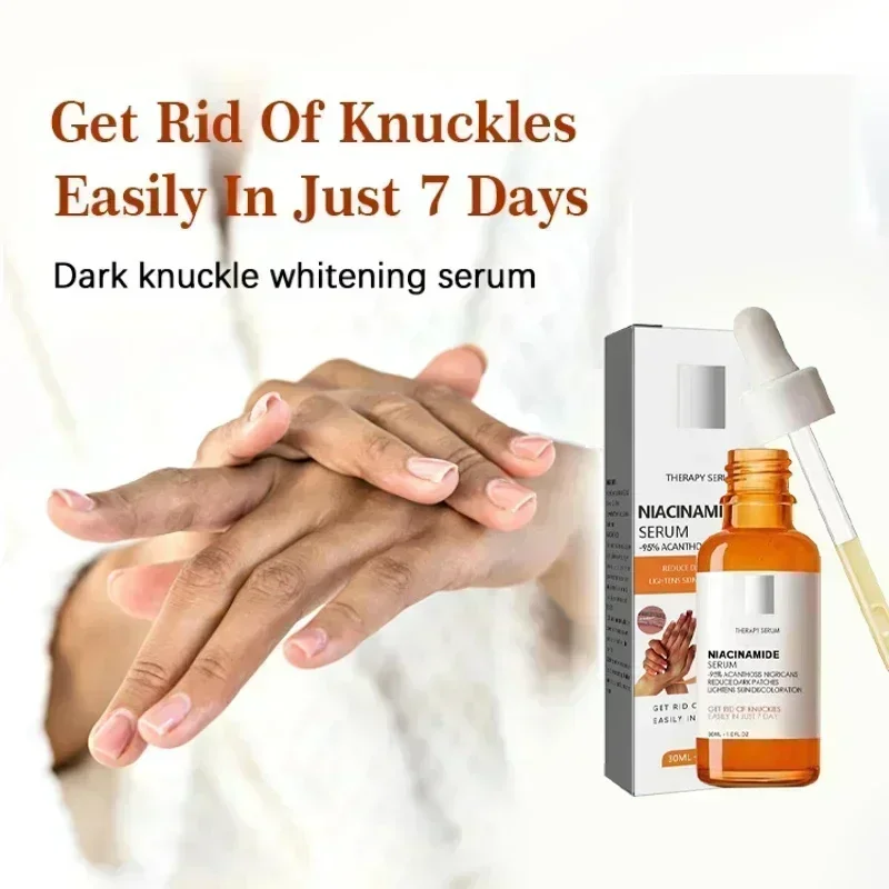 02SALE Fast whitening serum Elbows Armpit Beaching Serum Private Part Skin Removal Dark Knuckles Strong Whitening Serum