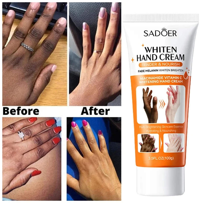 Dark Knuckles Hand Cream, Clareamento Rápido, Anti Cracking, Corretores de Pigmentação para Pele Negra, Removedor de Manchas Intenso