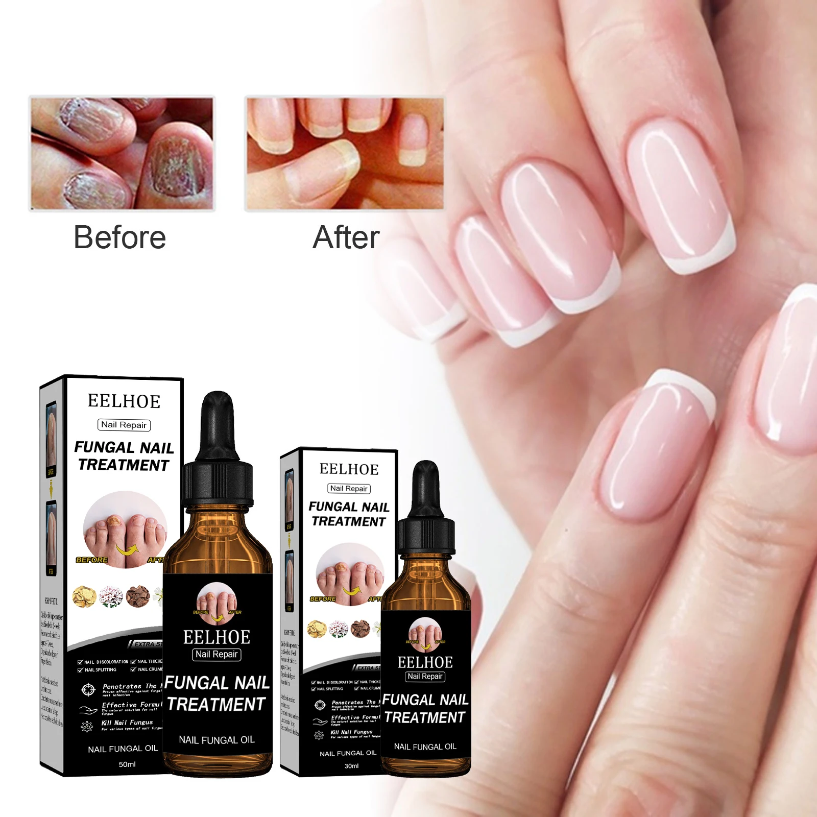 

Toenail Fungus Revitalizer Tough on Nails,Improve Onychomycosis and Nail Hardening Supports Toenail Repair,Nourishes,Plasticizes