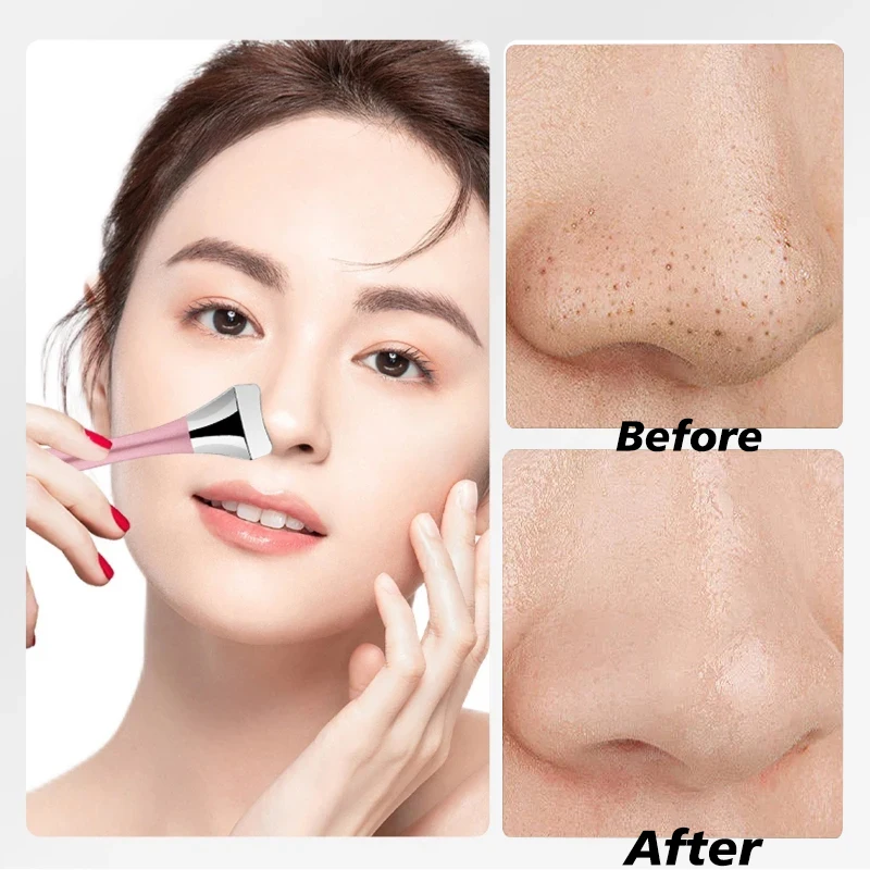 Stainless Steel Blackhead Removal Tool Double-Headed Face Scraping Acne Needle Pore Cleansing Tools Face Blemish Extractor Tools