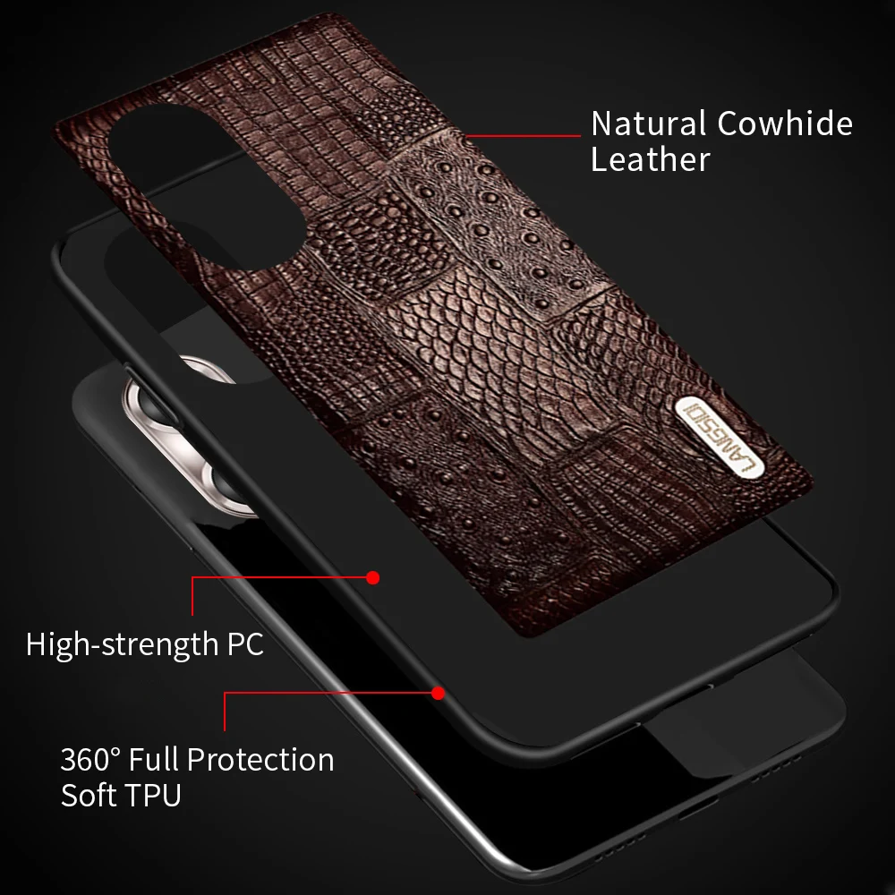 Genuine Cowhide Leather Phone Cases For Honor 60 Pro 50 Pro 30 10 20 Lite 10i 20i Cover For Magic 3 Magic3  V30 Pro Case