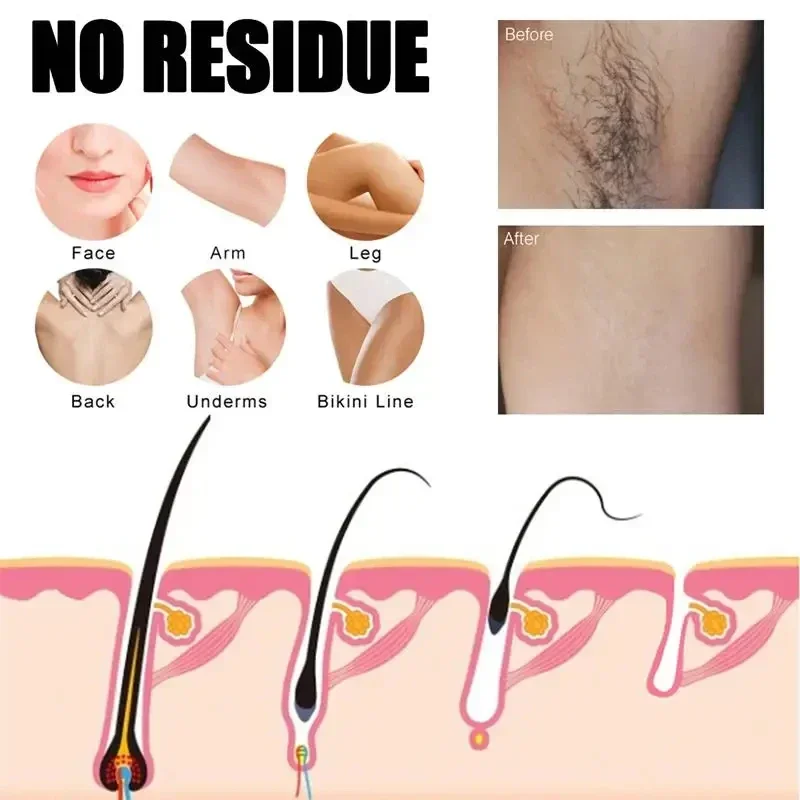 Painless Hair Removal Spray Chest Back Leg Arm Intimate Area Body Hair Removal Mild Smooth Skin Fast Easy Hair Removal Care