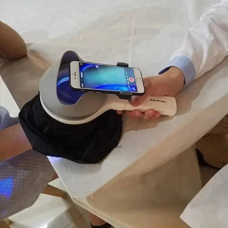 

KN-9000B Medical CE approved Combined Light UVA and LED woods lamp examination