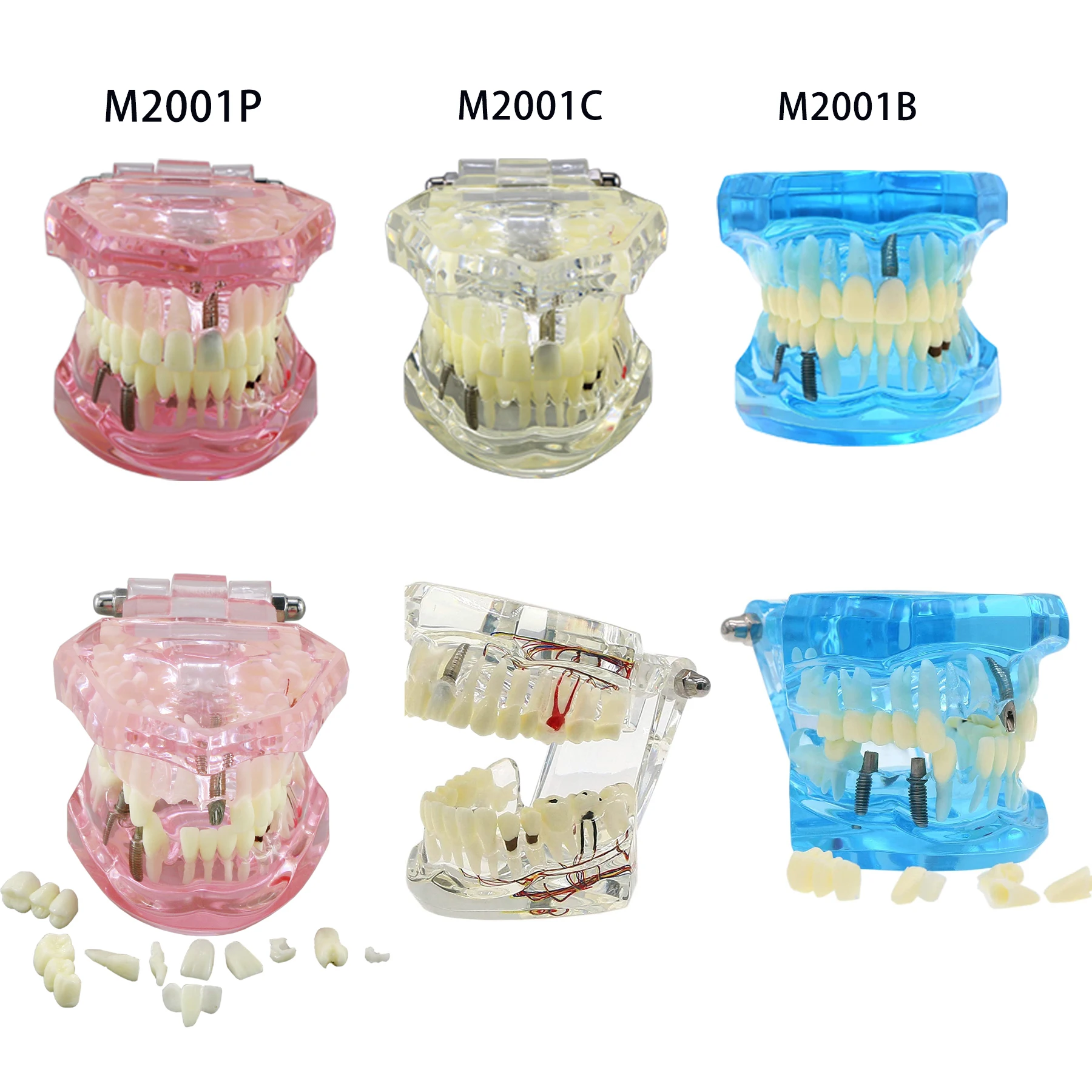 SEUJJRO Multifarious Types Dental Model Removable Teeth Implant Orthodontic Teaching Studing  Demo For Dentist Student School