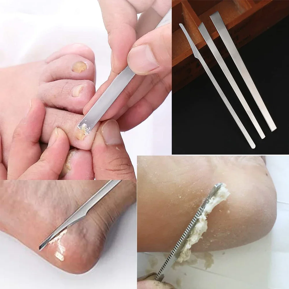 Sdotter 3pcs Pedicure Knife Kit Toe Nail Scraper Feet Manicure Tools Dead Skin Remover Files Toe Seperators Ingrown Nail Correct