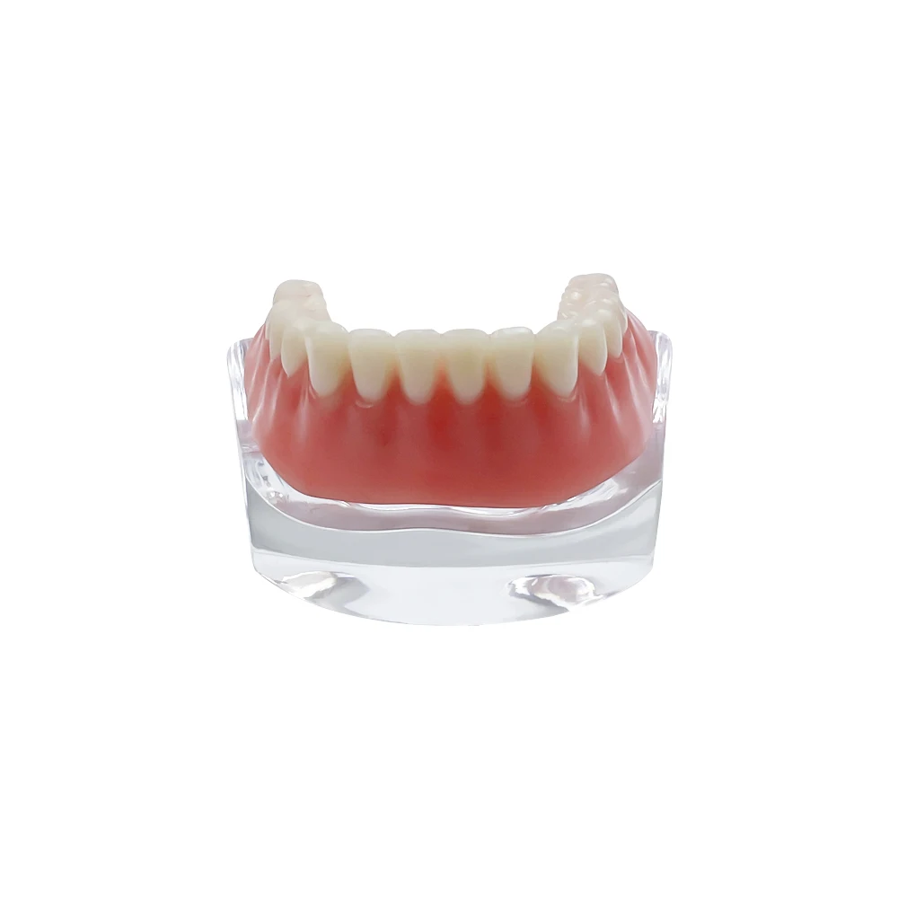 Zdejmowany model zębów Overdenture z 4-implantami dolnego mostu szczękowego Demo nauczania dla pacjentów dentystycznych Model złotego/srebrnego pręta