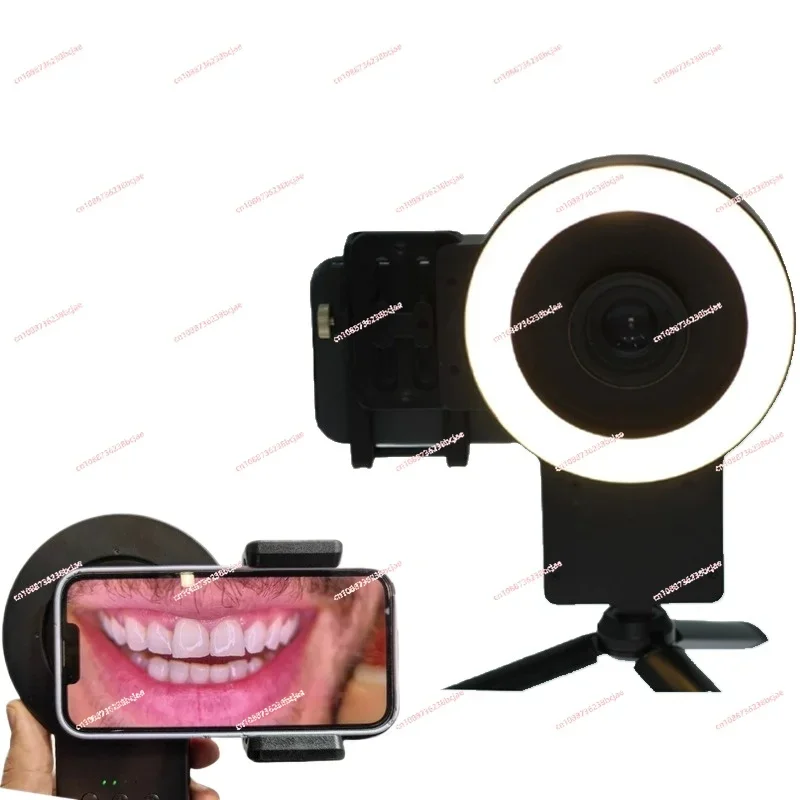 Oral shooting assistant photo special light Dental filling light Mobile phone macro live broadcast Nail art and beauty shadow