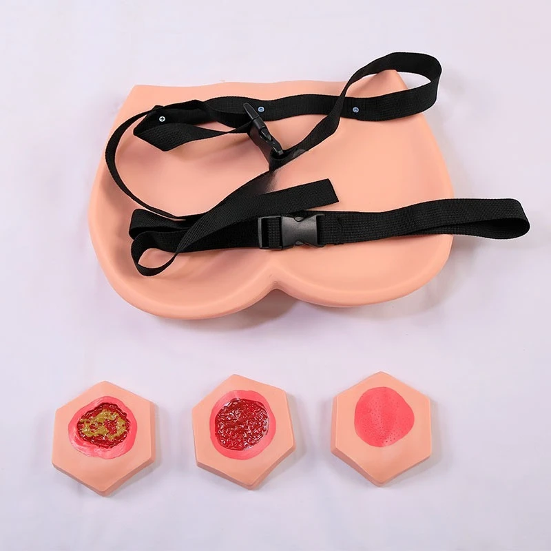 Advanced bedsore nursing training model, pressure sore wound cleaning, training model