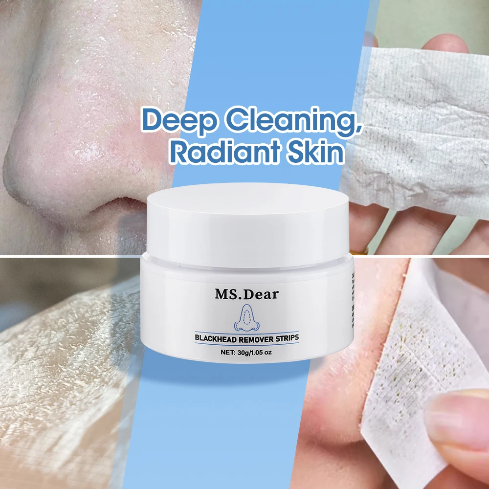Nuovo Rimozione di Comedone Maschera per il Naso Striscia di Pori Con 80 Pezzi di Carta Pulizia Profonda del Viso Strisce Nasali Peeling Trattamento Dell'acne Cura Della Pelle