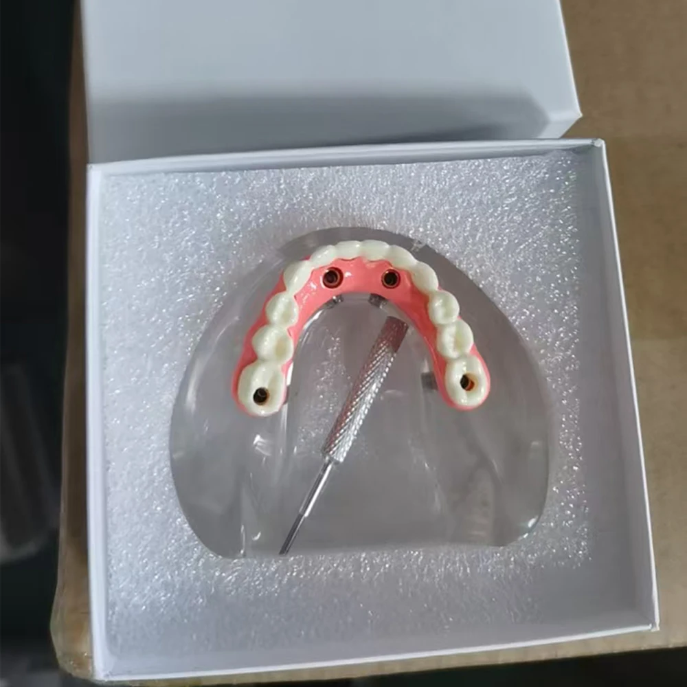 

Модель зубов для имплантации, нижняя челюсть, с 4/6 съемными имплантатами и винтами, для медицинских исследований, 1 шт.