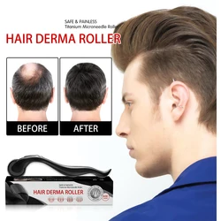 Derma rolo micro agulha dermaroller rebrota do cabelo anti tratamento da perda de cabelo natural do crescimento da barba do cabelo dos homens