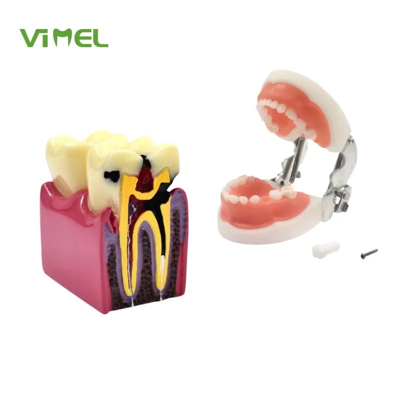 Oral Teeth Model For Dental Teaching Orthodontic Dentist Training Anatomical Oral Teeth Model Dental Typodont models