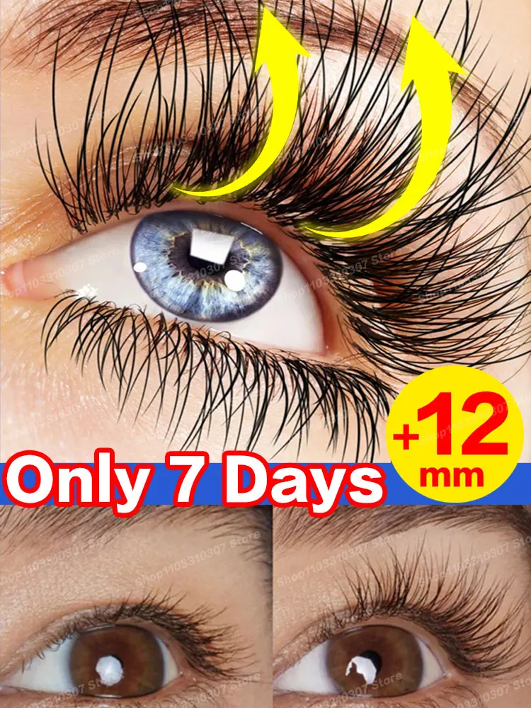 Eyelash Growth Serum Thick Eyelashes