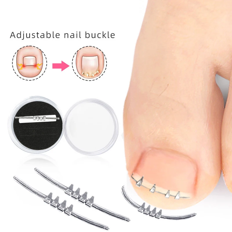 

1pc Ingrown Toenail Correction Foot Care Adjustable Onychocryptosis Paronychia Toe Nail Buckle Pedicure Straightening Clip Brace