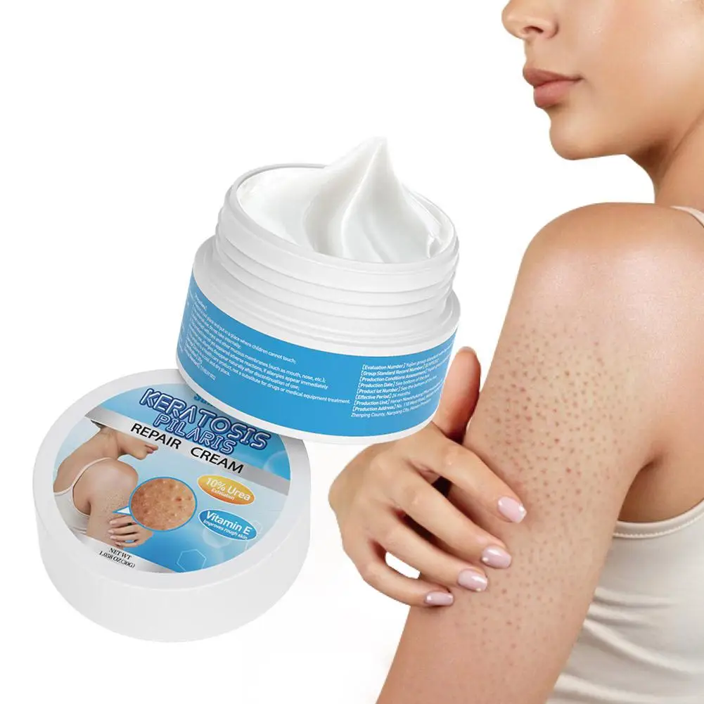 Crema hidratante para el cuidado de la piel, exfoliante corporal con vitamina E, fresa, eliminación de piernas, piel de pollo, Urea exfoliante, crema blanqueadora, granos, R7X2, 30g