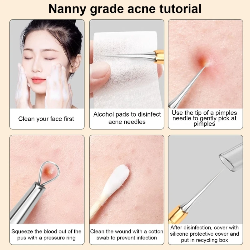 3 ใน 1 สิวหัวดำ Extractor แหนบกำจัดสิวมืออาชีพสำหรับโฮมสปา