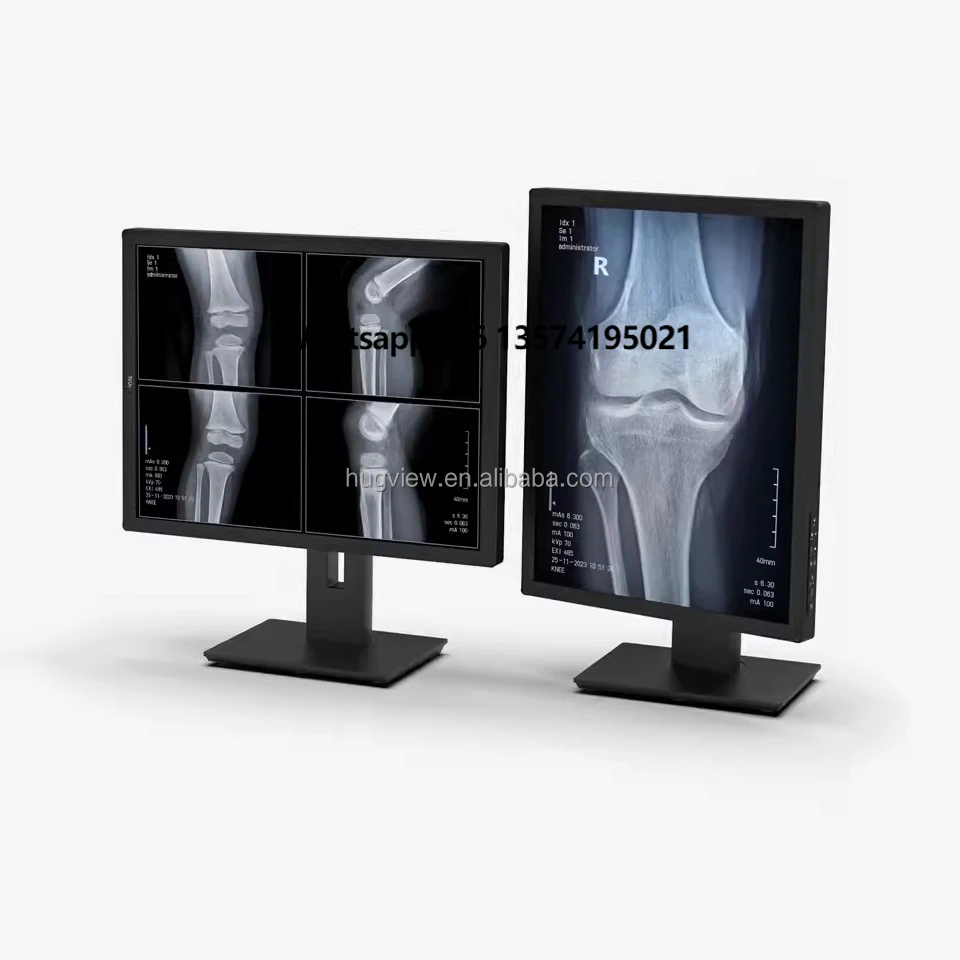 New 21.3 Inch 3Mega M Vertical Screen Grey Scale CT Reading X-ray DR Radiology Diagnostic DICOM Medical