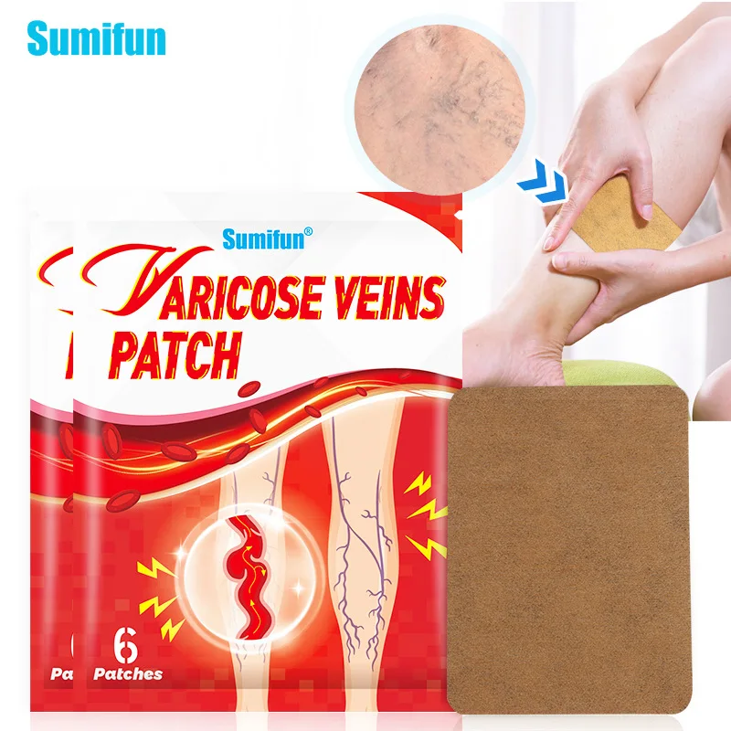 Vasculitis Phlebitis Spider Cream Varicose Veins Patch Varicosity Angiitis Ointmnet Removal Herbal Medical Plaster