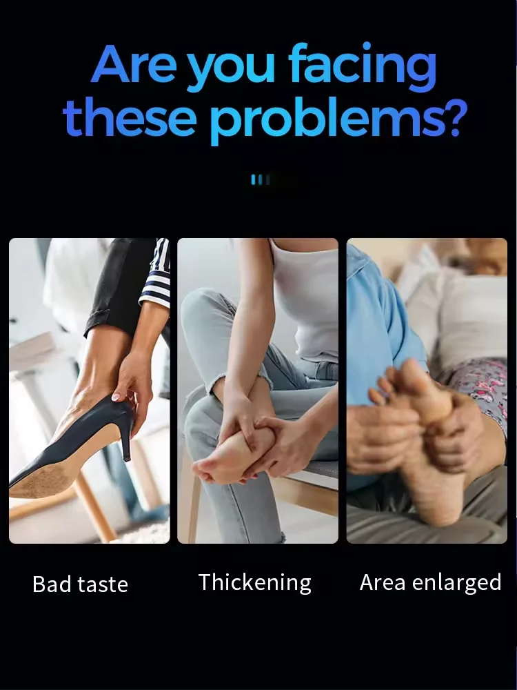 Technology changes life, say goodbye to onychomycosis, no recurrence, no damage to nails