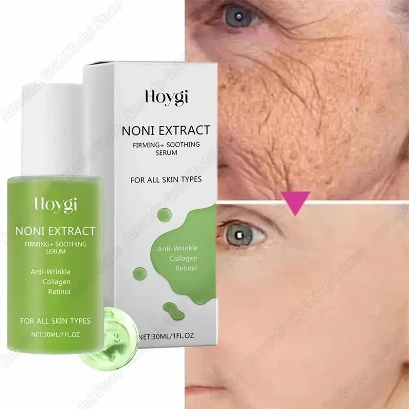 Noni Fruit Essence Noni Extract Energy Ampoule Face Serum Korean Anti-wrinkle Moisturizing Sooth Wrinkle Fine Line Skin Care