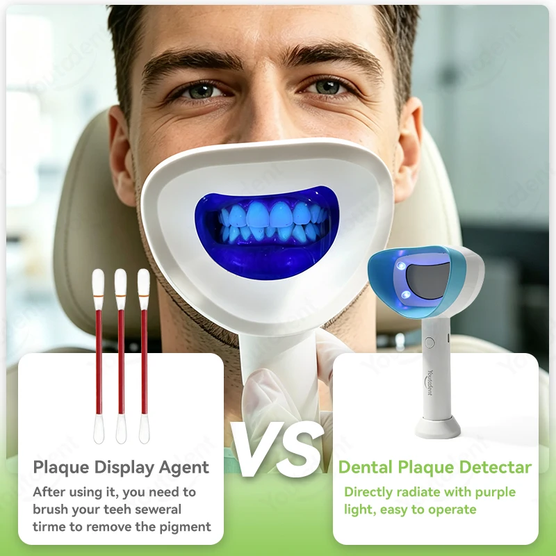 Dental Plaque Detector Real‑time Mirror Display LED Purple Light Teeth Plaque Tester Oral Care Detector for Dentist Home Use