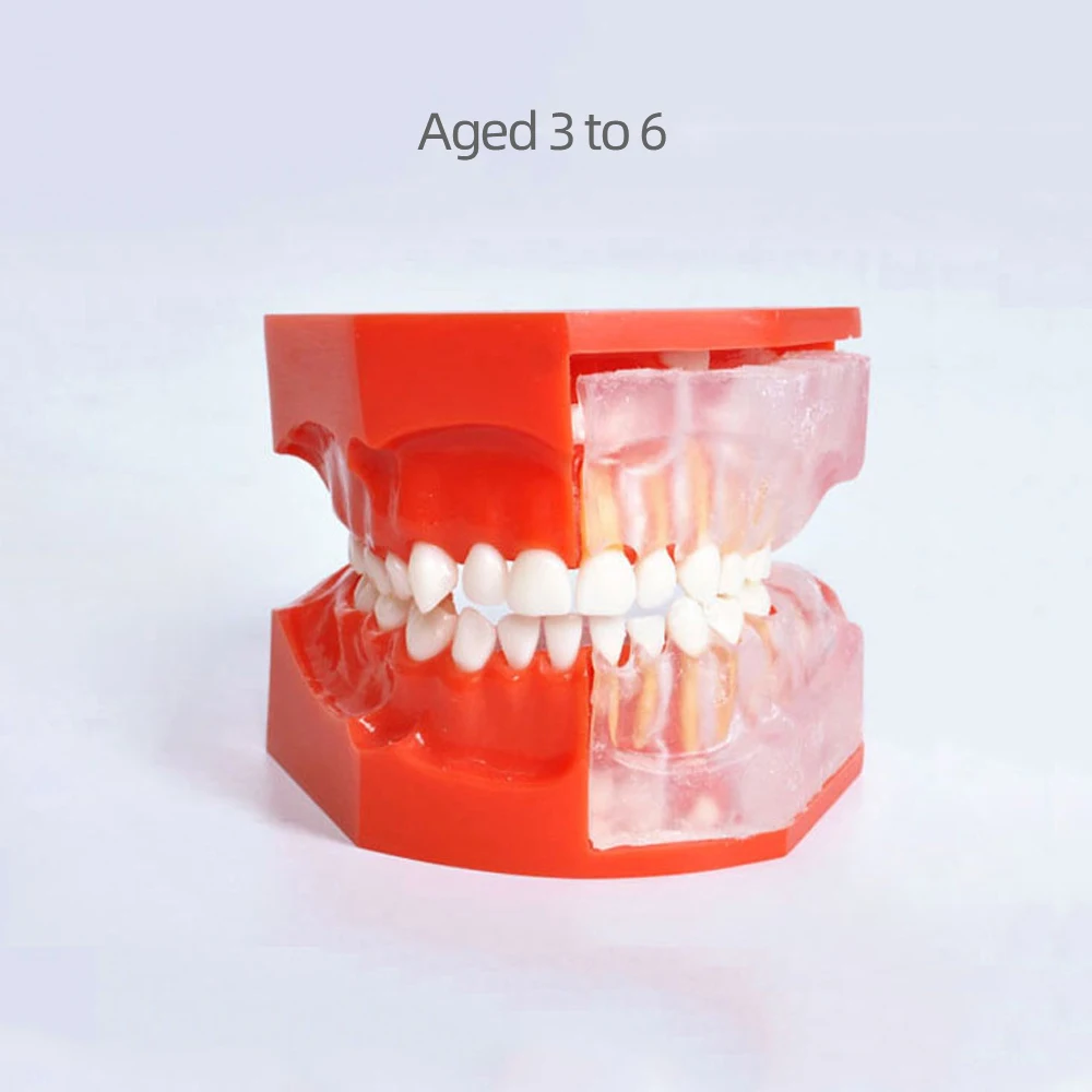 

Зубная модель зубов, имплантат со съемной стоматологической образовательной моделью для стоматологической лаборатории, демонстрационный инструмент для стоматологических продуктов