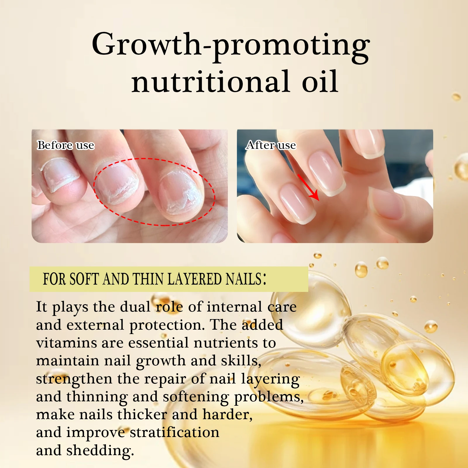 Huile nutritive pour favoriser la croissance des ongles, 12ml, pour réparer les ongles en couches douces et fines, superposition des ongles, huile de soin des ongles de haute qualité