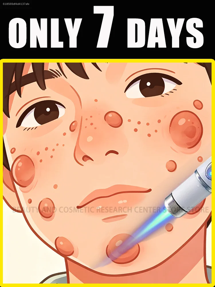 

The safe blue light causes the skin to detach naturally, without pain or leaving any trace.