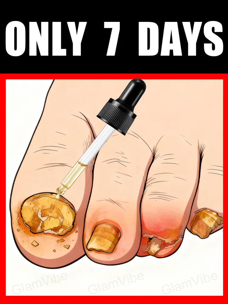 

2025 Tᴏᴇɴᴀɪʟ Fᴜɴɢᴜs Pᴀᴛᴄʜᴇs Rᴇᴘᴀɪʀ Dɪsᴄᴏʟᴏʀᴇᴅ Dᴀᴍᴀɢᴇᴅ Nᴀɪʟs Fᴏᴏᴛ Cᴀʀᴇ