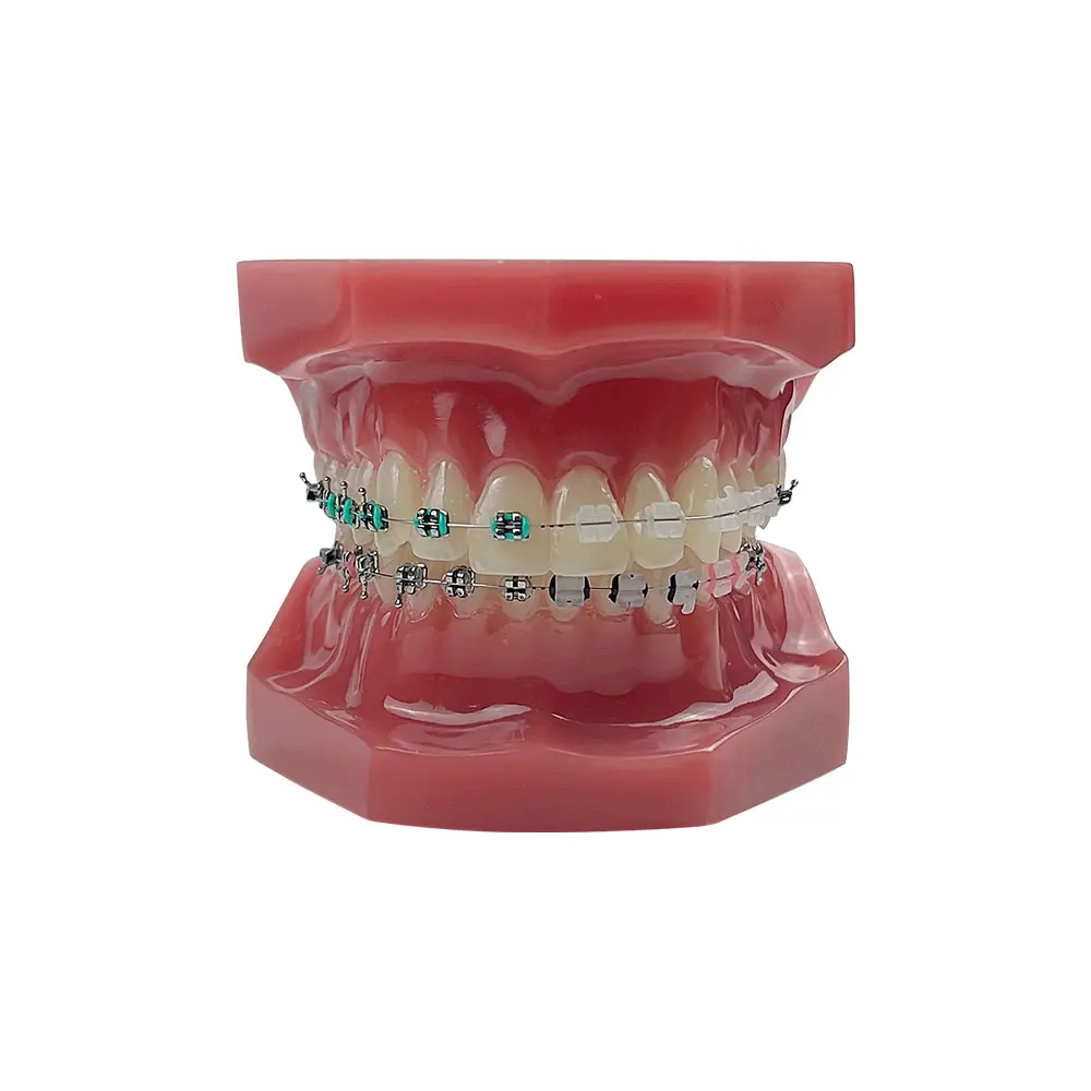 Orthodontic Model Tooth Model for Dentist Student Studying Training Practice Teaching Doctor-patient Communication Tool