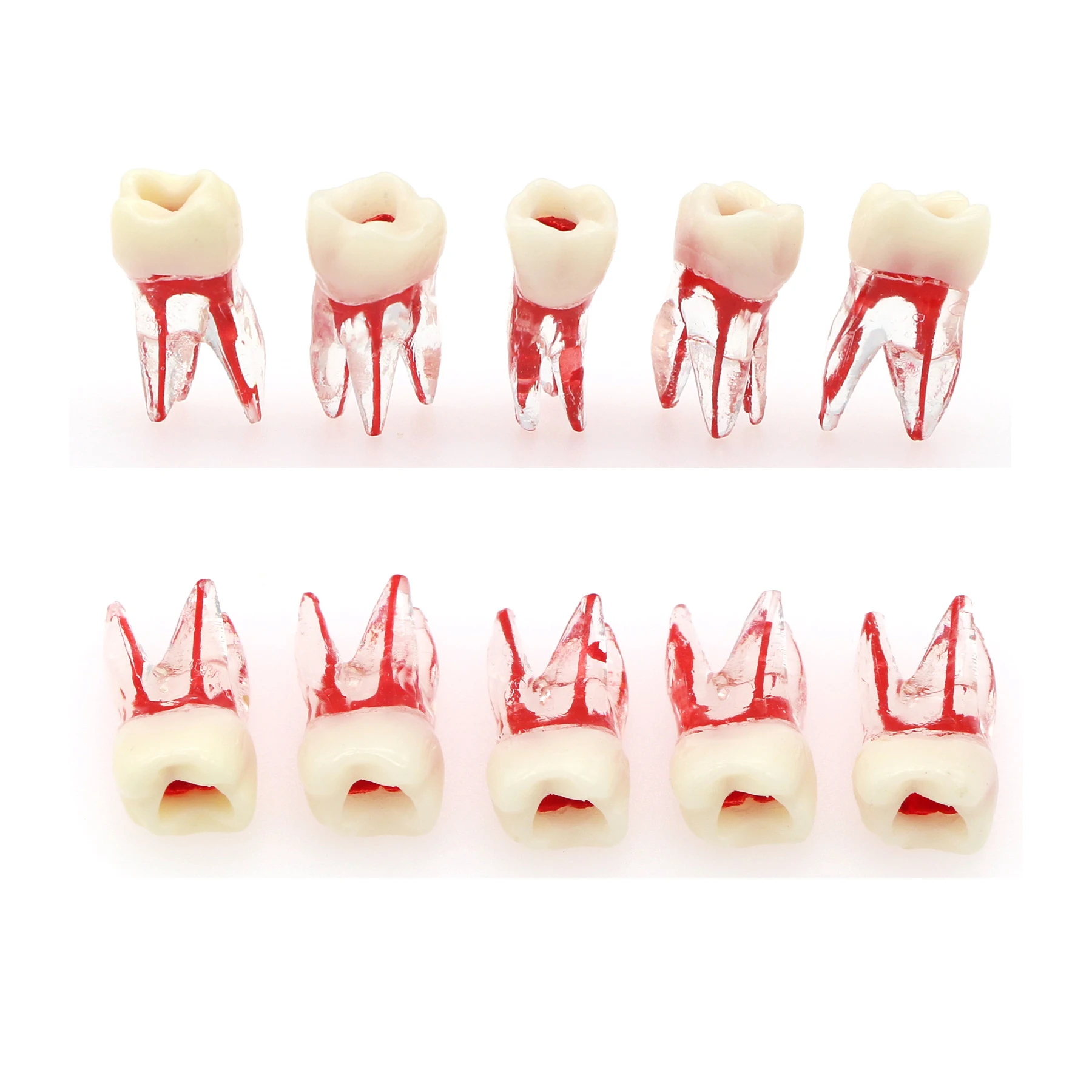 Dental  Root Canal Teeth Model Endodontic File RCT Practice Block Pulp Cavity Training  Operation with Colored  Teaching Study