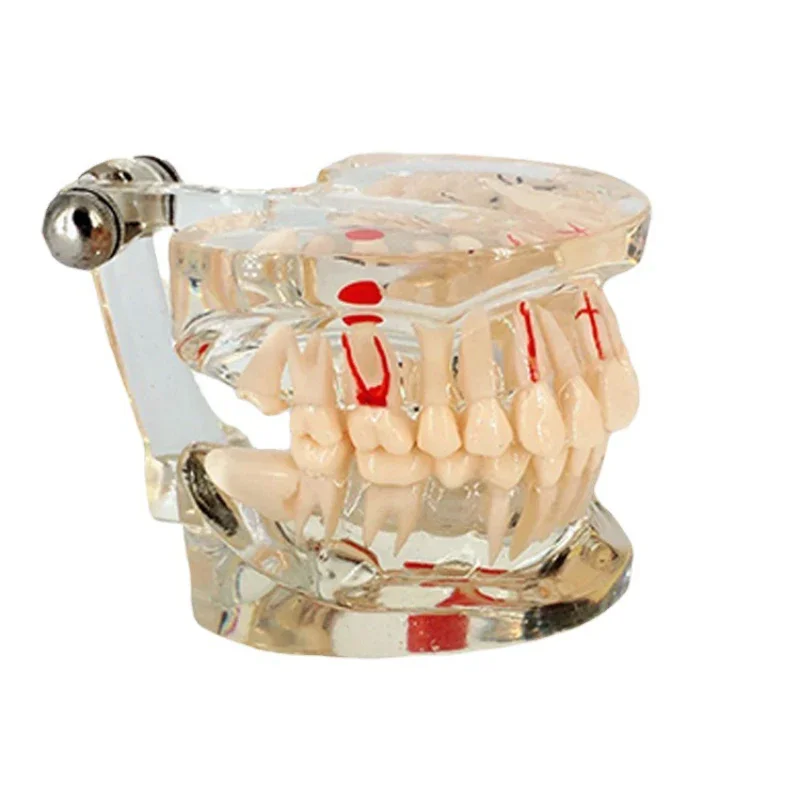 Dental Teeth Model For Studying Education Transparent Tooth Implant Model