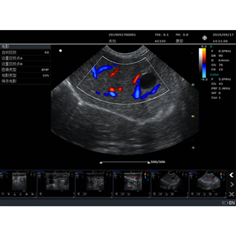 HF-K10 mindray ultrasound machine veterinary ultrasound equipment on sale