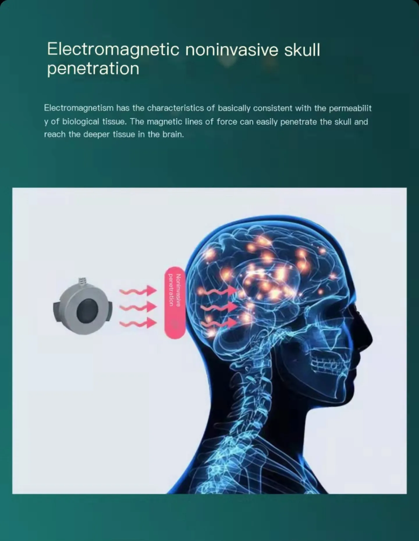 Transcranial Magnetic Stimulation for Stroke,adult and Children Insomnia Anxiety Depression Autism Brain Therapy Apparatus