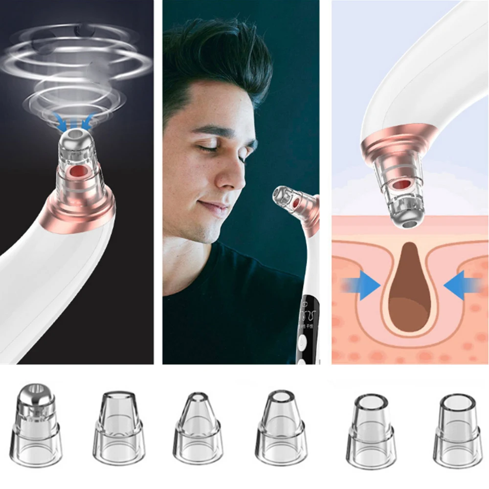 Elektrische Comedondrukker Gezicht Pore Cleaner Vacuüm Zuig Acne Puistje Zwarte Kop Verwijderen Huidverzorging Gereedschap Facial Pore Cleanser