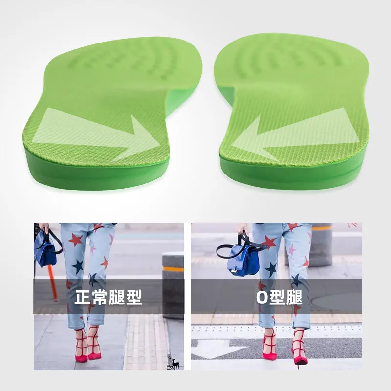 O/X Leg Backward Rotation Insole Bow leg Orthopedic Insole Male Female Correction Backward Rotation Side Heel Wedge Insole