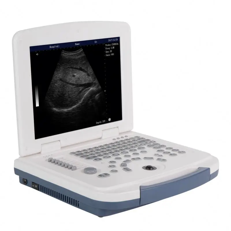 Portable ultrasound vet machines msk ultrasound machine obstetric for ob equine ultrasound machine