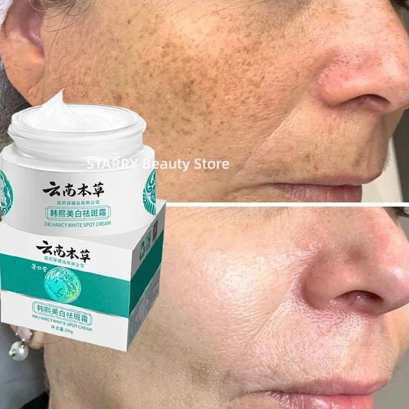 

Effective Whitening Freckle Cream Remove Melasma Dark Spots Melanin Reduce Fine Lines Moisturize Brighten Smooth Skin Beauty