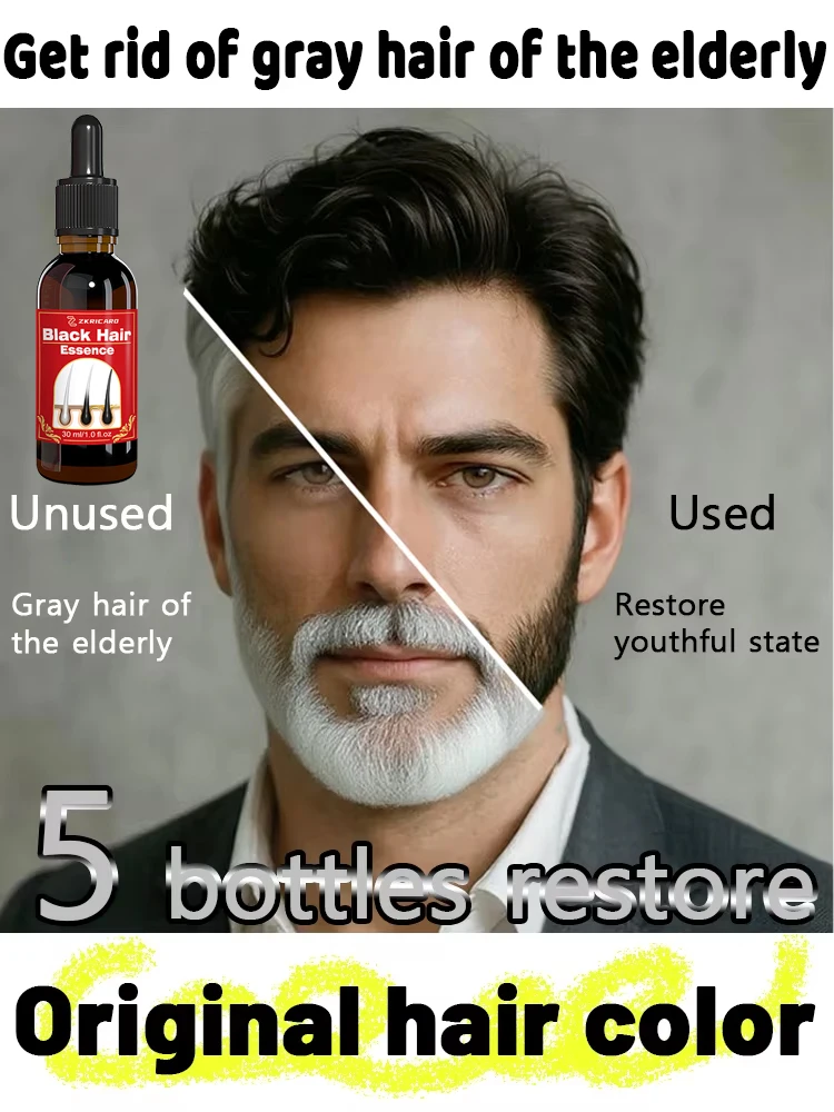 

Я не хочу белых волос. Я хочу мои черные волосы