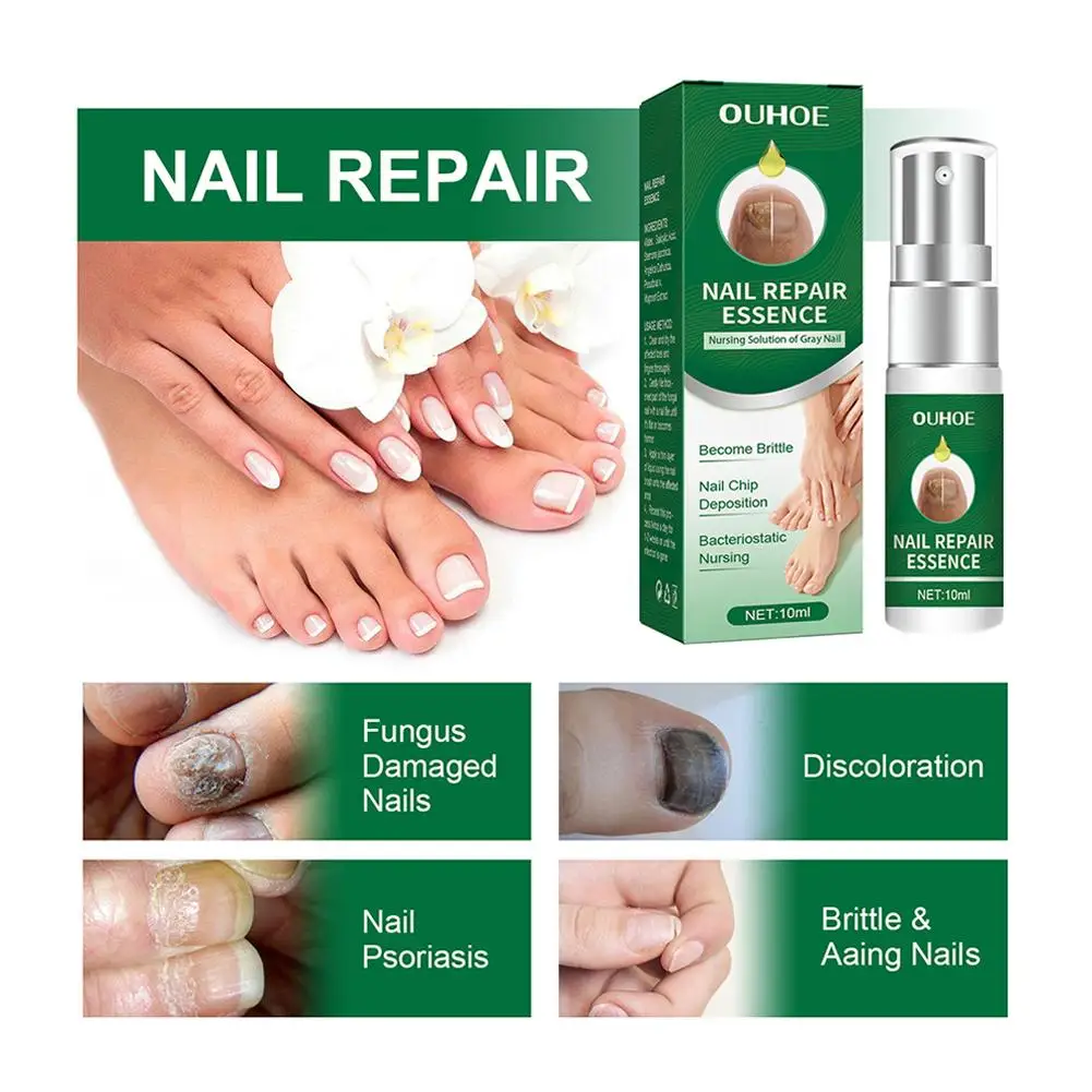 Reparación de uñas multiusos, esencia de reparación de uñas de los pies, protege las uñas de daños, para reparar uñas descoloridas y dañadas, 10ml