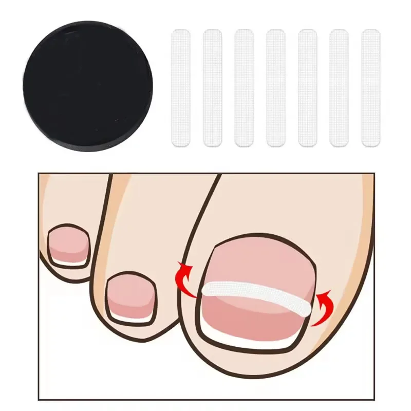 10Pcs Ingrown Toe Nail Treatment Ingrown Toenail Correction Tool Elastic Patch Sticker Straightening Clip Brace Pedicure Tools